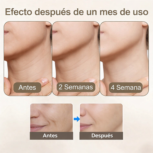 Masajeador facial LED FaceLift Aura™